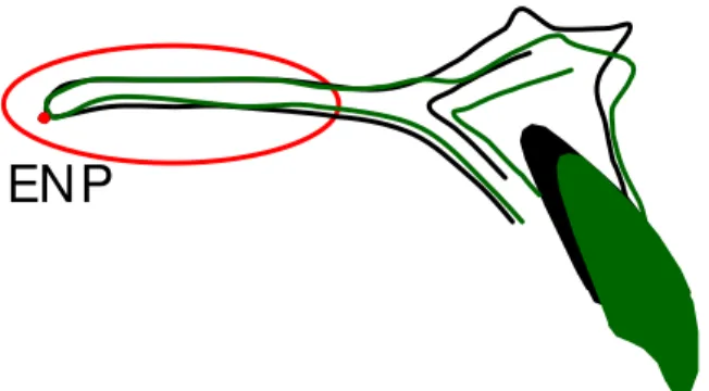 FIGURA 8 - Sobreposição na porção posterior  maxilar para transferência do ponto ENP. 