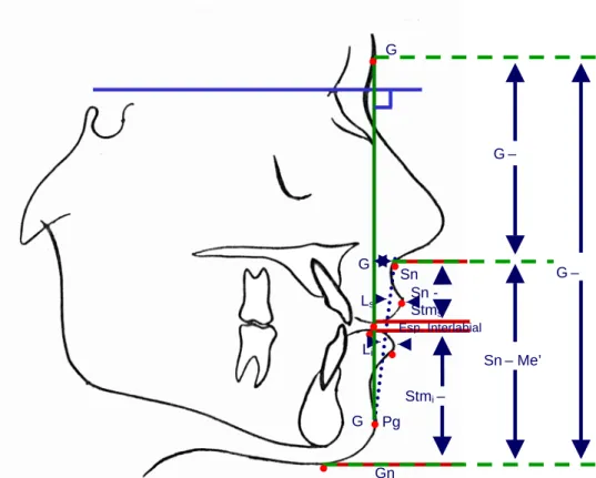 FIGURA 11 - Medidas lineares e proporção facial.