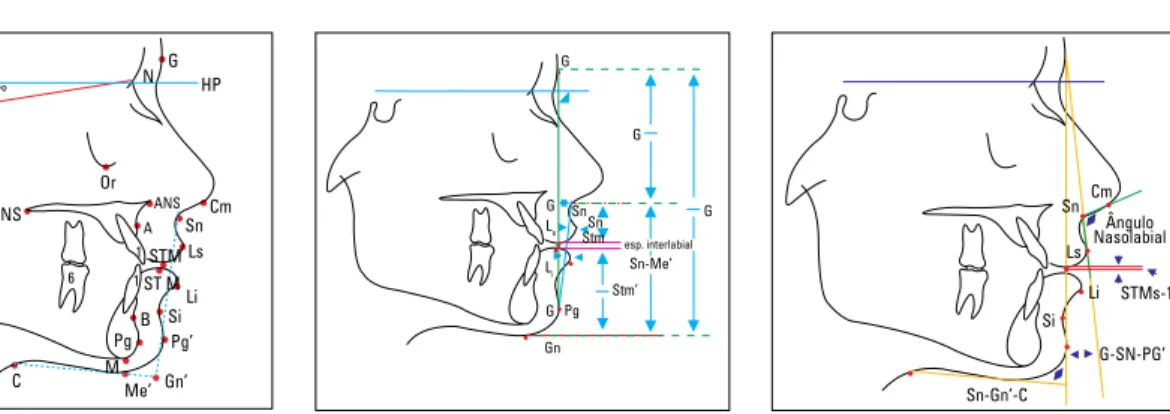 FIGURA 3 - Traçado das estruturas anatômicas e  pontos utilizados para a análise cefalométrica.