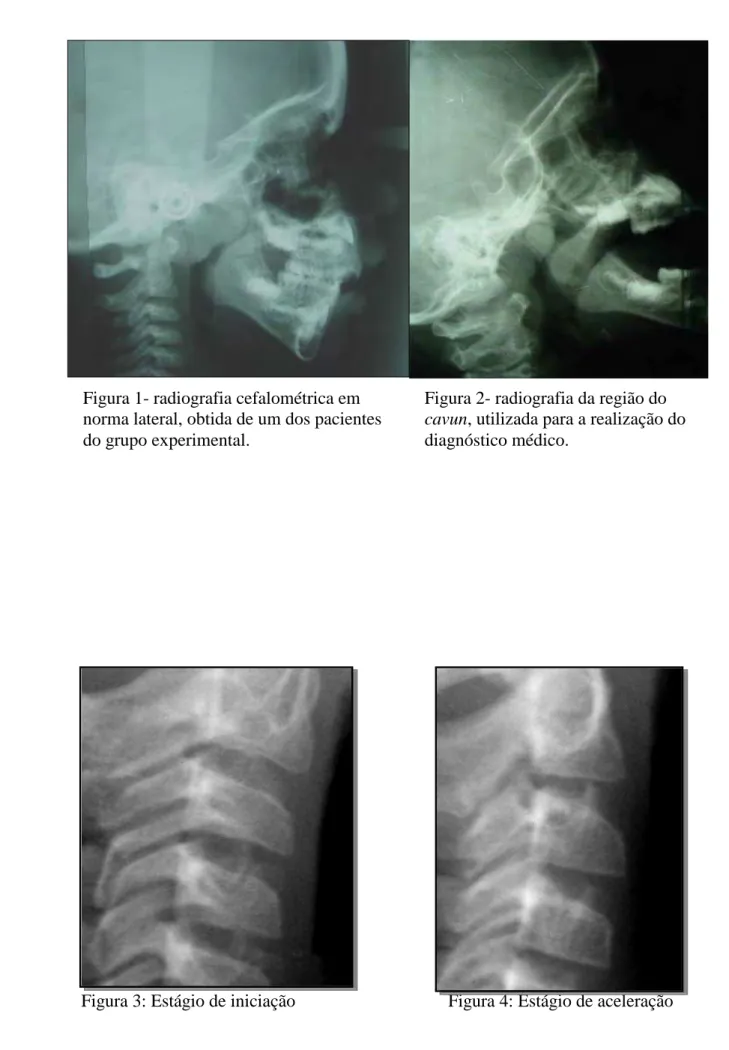 Figura 2- radiografia da região do  cavun, utilizada para a realização do  diagnóstico médico
