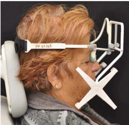 Figura 8- Vista lateral do aparato para o registro dos movimentos  mandibulares composto  por sensores eletromagnéticos
