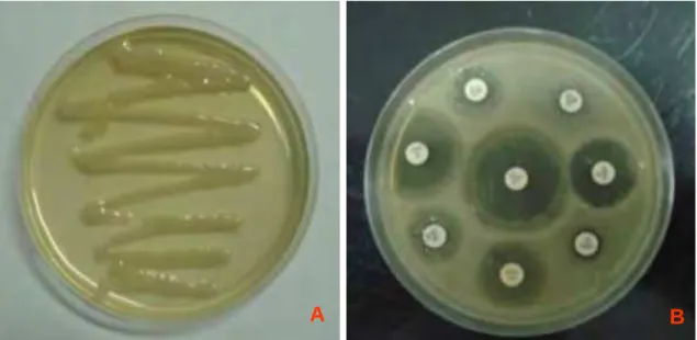 Figura 01: Imagens das placas utilizadas para cultura e antibiograma, sendo “A”  crescimento bacteriano de uma amostra semeada em meio de ágar Mac Conkey e “B”  teste de antibiograma através da medição das zonas de inibição (VOLPATO et al, 2008)  