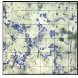 FIGURA 8 – Observação em microscopia óptica  (magnificação 400x) do corpo de  prova de resina termopolimerizável  – controle positivo