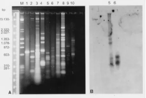 Fig. 4:  agarose gel showing Hae III restriction profiles (A) and the corresponding autoradiography after hybridization with the radiolabelled total kDNA from the patient’s isolate (B)