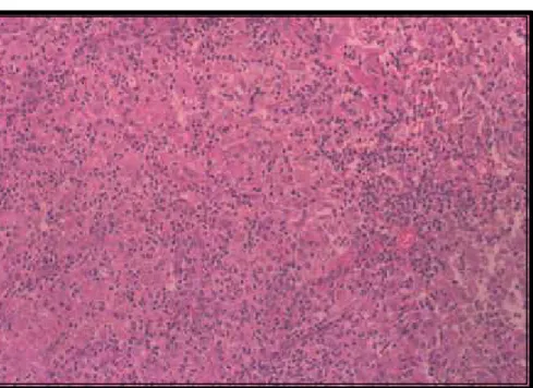 FIGURA 07.  Intensa inflamação piogranulomatosa no tecido subcutâneo, ao  15 o  dia de infecção, em felinos (Felis catus) inoculados  experimentalmente com S.schenckii (H&amp;E-50X)