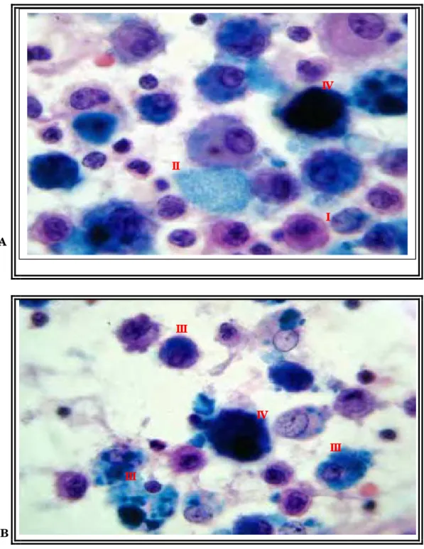 Figura 7 – Hemossiderófago grau I; II, III e IV (A e B) de células do  lavado broncoalveolar de cavalos QM, submetidos ao exercício -  Giemsa (1000x)