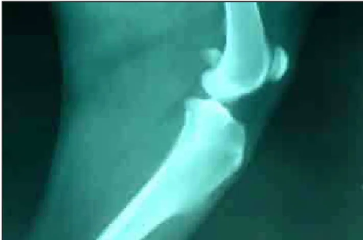 Figura 7: Radiografia da articulação femuro-tíbio-patelar esquerda em projeção médio lateral