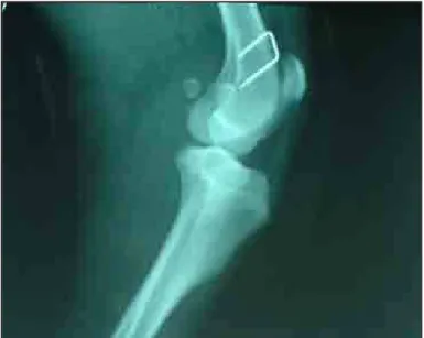 Figura 15: Aspecto radiográfico na projeção médio-lateral da articulação femurotíbiopatelar esquerda aos 15 dias de  pós-operatório