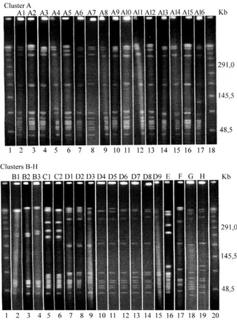 Fig. 1: pulsed-field gel electrophoresis (PFGE) profiles displayed by  the Ia group B streptococci strains