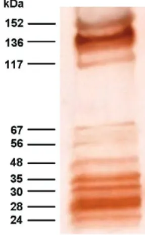 Fig. 1: immunoblot analysis of Toxocara excretory-secretory antigens  against a pool sample from toxocariasis positive human sera, showing  10 antigenic bands.
