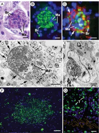 Fig.  12:  light  and  electron  micrographs  of  cyst  rupture  in  immuno- immuno-competent  mice  (A-E)  and  light  micrographs  from  an  AIDS  patient  with recrudescent toxoplasmosis (F, G); A-C: sections through a  rup-tured  tissue  cyst  stained 