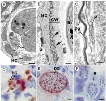 Fig.  5:  comparison  of  the  structure  of  the  parasitophorous  vacuole  by  TEM  (A-C)  and  expression  of  GRA6  identified  by   immuno-cy-tochemistry  using  peroxidise  as  chromogen  (D-F)  in  the  tachyzoite  (A, D), the tissue cyst (B, E) and