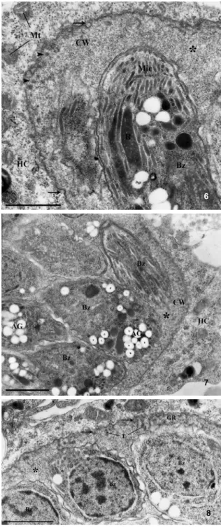 Figs  6-8:  transmission  electron  microscopy  analysis  of  skeletal  muscle cells after 31 days of infection with  Toxoplasma gondii  bra-dyzoites