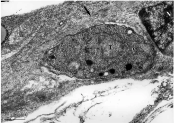 Fig. 2A: tachyzoites (T) of Toxoplasma gondii and skeletal muscle cell  by scanning electron microscopy