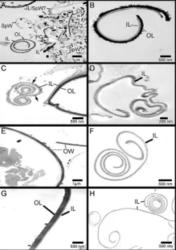 Fig. 2: electron micrographs showing the effect of bleach on oocyst  wall (OW) preparations from Eimeria tenella and Eimeria maxima