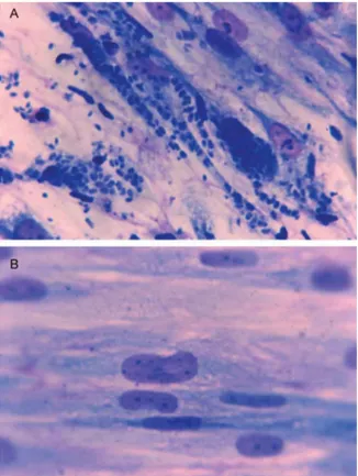 Fig. 1A: Toxoplasma gondii tachyzoites in tissue culture with medium  alone; B: with antimicrobial agent
