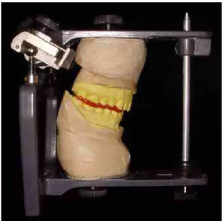 FIGURA 12 - Montagem do modelo mandibular  em articulador em RC com o  registro interposto