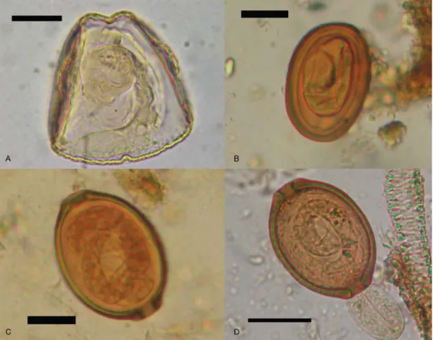 Fig.  3:  A:  egg  of Monoecocestus  sp.  at  100X  (onchospheral  hooks  can  be  observed);  B:  embryonated  egg  of Pterygodermatites  sp.;  C:  em- em-bryonated egg of Trichosomoides, probably T