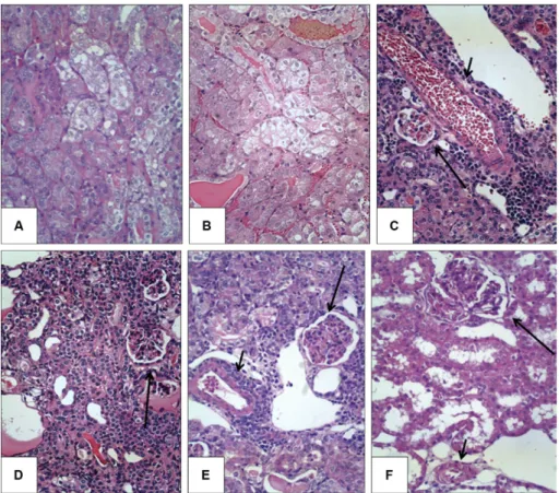 Fig. 5: typical lesions of leptospirosis in the infected hamsters. A: marked swelling of the epithelial cells of the proximal tubules in an untreated  hamster at day 8; B: other focus of tubular cell swelling in an untreated hamster at day 16; C: mild inte