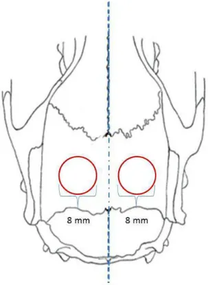 Figura 2 – Desenho esquemático do defeito ósseo criado em ambos os lados da calvária com 