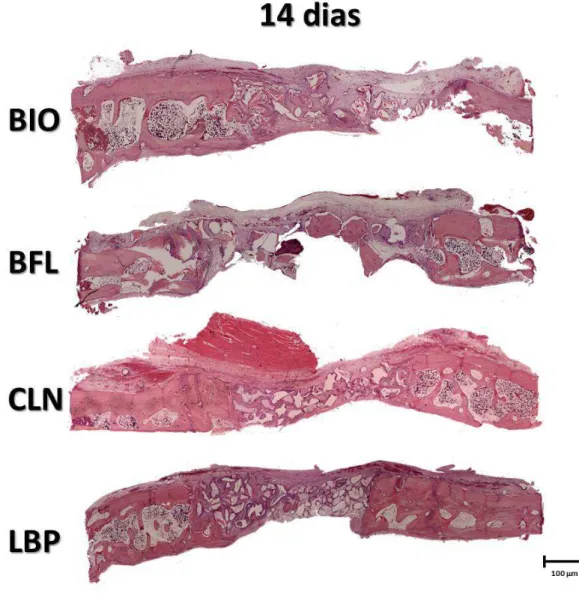 Figura 3 – Aspecto histológico representativo dos biomateriais de preenchimento dos defeitos  ósseos (BIO, BFL, CLN e LBP), no período experimental de 14 dias (Coloração  HE, aumento  original 40X)