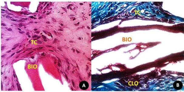 Figura 4  –  Aspecto histológico em detalhe da relação do biomaterial BIO 14 dias e tecidos  circunjacentes na região central do defeito