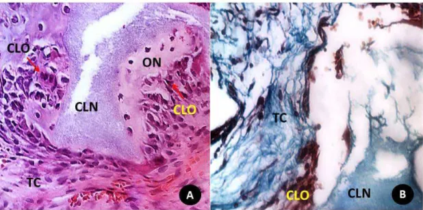 Figura 6  -  Aspecto histológico em detalhe da relação do biomaterial CLN 14 dias e tecidos  circunjacentes na região central do defeito