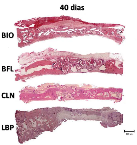 Figura 8 - Aspecto histológico representativo dos biomateriais no preenchimento dos defeitos  ósseos (BIO, BFL, CLN e LBP), no período experimental de 40 dias  (Coloração  HE, aumento  original 40X)