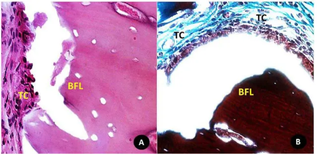 Figura 10  -  Aspecto histológico em detalhe da relação do biomaterial BFL 40 dias e tecidos  circunjacentes na região central do defeito