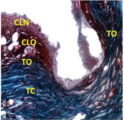 Figura 11  -  Aspecto histológico em detalhe da relação do biomaterial CLN 40 dias e tecidos  circunjacentes na região central do defeito