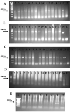 Fig. 4: detection of Wuchereria bancrofti  DNA in samples of serum  and  urine  from  patients  using  polymerase  chain  reaction  (PCR)