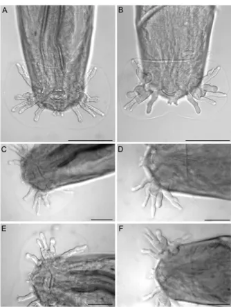 Fig. 4: light microscopy of Angiostrongylus cantonensis. A: ac8 haplo- haplo-type; B: ac9 haplotype, dorsal view of caudal bursa; C: ac8 haplohaplo-type; 