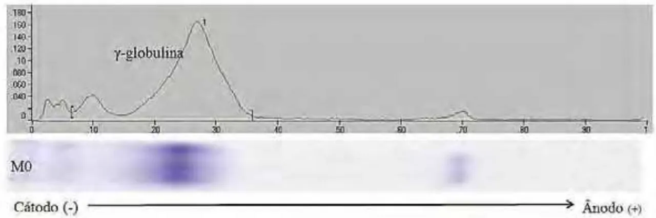 Figura 6 - Análise Densitométrica do soro do colostro no momento 0h. Relação  entre corrida eletroforética SDS-PAGE 10% e análise no Image Master® VDS 4 