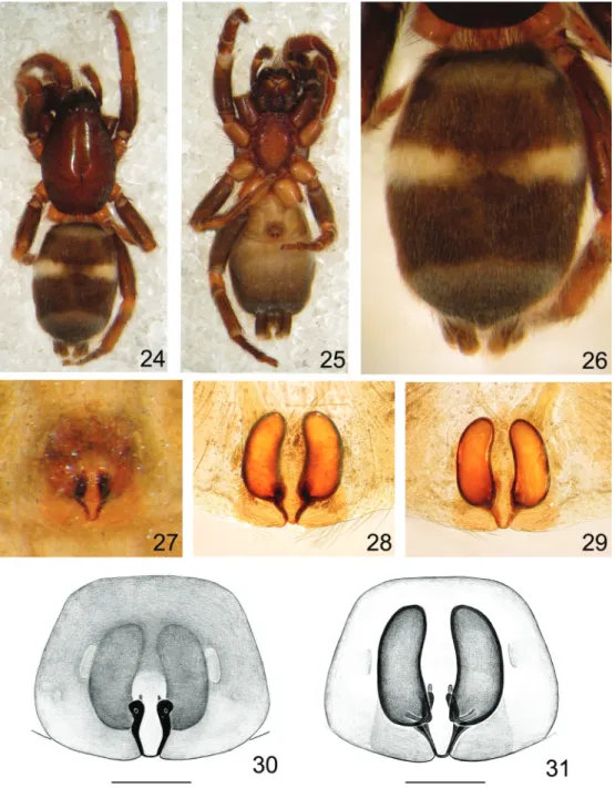 Figs 24-31. Latonigena lami sp. nov., paratype ♀ (MCN 38236): 24, dorsal; 25, ventral; 26, abdomen, dorsal; epigynum: 27, ventral, not dissec- dissec-ted; 28, 30, ventral; 29, 31, dorsal