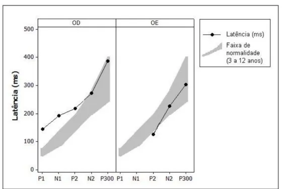 Gráfico 3 -  Valores  de  latência  do  PEALL  de  G.S.  e  limites  de  normalidade segundo McPherson (1996) 