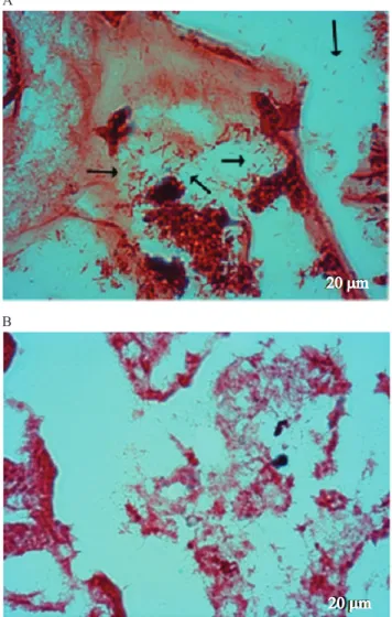 Figura 2.   Preparação  histológica  típica  do  lúmen  intestinal de alevinos de tilápia-do-nilo, alimentados  com dietas suplementadas (A) ou não (B) com probiótico  Lactobacillus plantarum  (1000 ×)