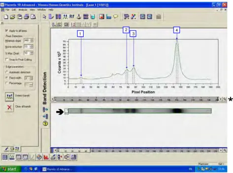 FIGURA 6-  Análise da imagem de uma das canaletas () pelo programa Phoretix 1D  Advanced, com a detecção das bandas dos marcadores (bandas 1 e 4) e  das bandas de interesse (2 e 3)