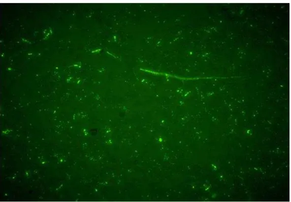 Figura  6.  Imagem  de  Histatina-5  no  interior  de  blastósporos  e  hifas  de  Candida  albicans,  obtida por microscópio de fluorescência (InCell Analyzer 2000 – GE Health Care Bio-Sciences)