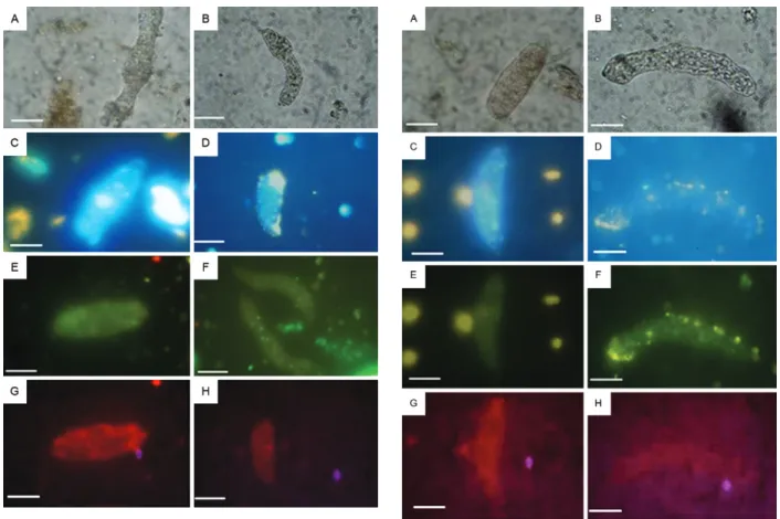 Fig. 5: action of internal defence systems of Biomphalaria tenagophila  from Cabo Frio on the membrane of primary (A, C, E, G) and  second-ary (B, D, F, H) sporocysts