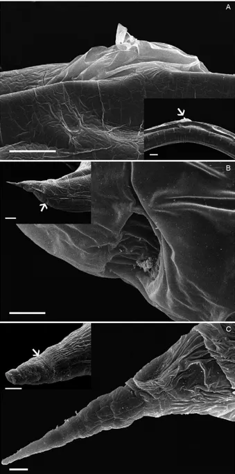 Fig. 5: scanning electron microscopy of Rhabdias paraensis sp. nov. A: 