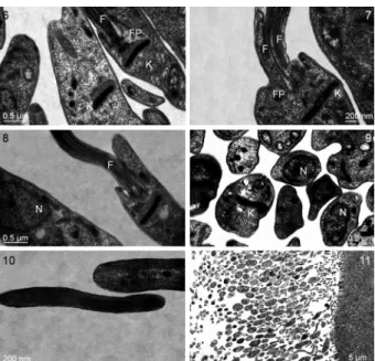 Figs 1-5:  morphology  of Blastocrithidia  cyrtomeni  sp.  nov.  from  in- in-fected hosts as revealed by light microscopy