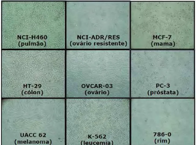 Figura 9 - Linhagens de células tumorais humanas utilizadas no ensaio                    antiproliferativo