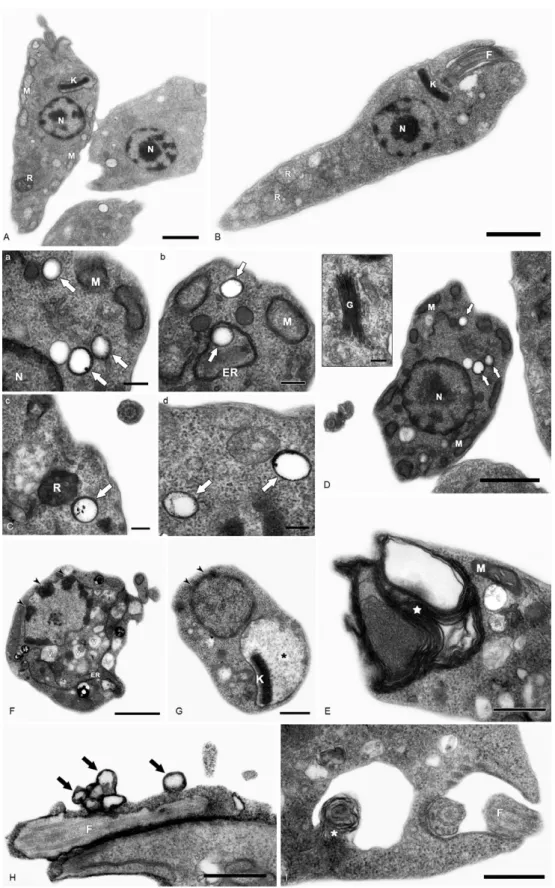 Fig. 5: transmission electron microscopy analysis of Trypanosoma cruzi epimastigotes labeled with cadmium telluride quantum dots (QDs).