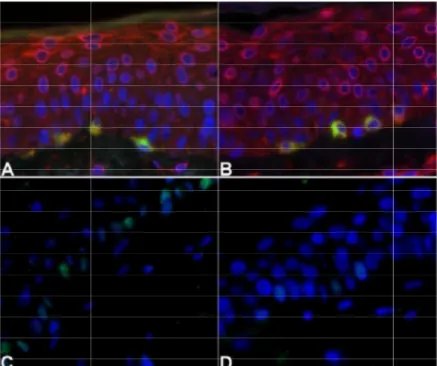 Figura 2. (A) Melasma. Imunofluorescência de dupla marcação paraCOX2 (vermelho) e Melan Pele sã adjacente