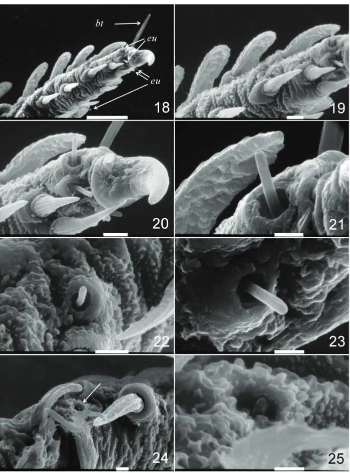 Figs 18-25. Andocaeculus caioi sp. nov., paratype ♀, scanning electron microscope images, Leg I: 18, tarsus, ventro-prolateral view; 19, same,  detail; 20, tarsal claws, same view; 21, distal eupathidium, same view; 22, tarsal medial eupathidium, ventral v