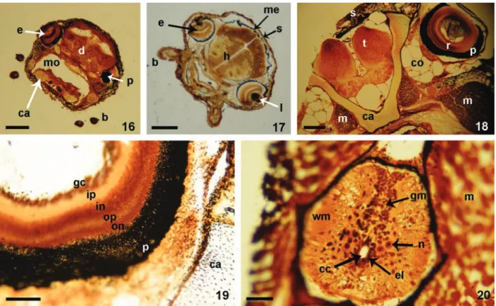 Figs 16-20. Coronal histological sections from decalcified, silver-impregnated specimens of Corydoras  aff