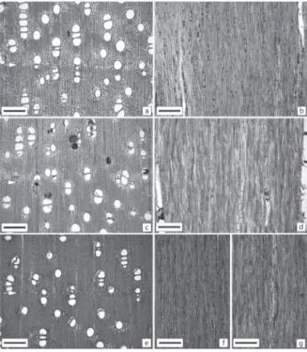 Figure 4. Variations in potential hydraulic conductivity between  root and stem (heartwood-when it was functional-and sapwood)