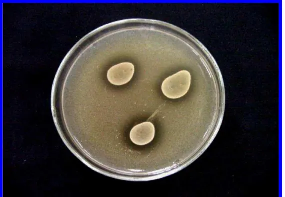 Figura 3 –  Ação de substâncias antimicrobianas de Lactobacillus reuteri, frente  a Lactobacillus helveticus como microrganismo indicador, em meios  BHI e MRS