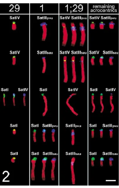 Figure 2.  Image showing enlarged comparison  of the in-situ hybridization  with satellite probe sequences in Figure 1b, d, f, h, j for autosomal   chromosomes 29, 1, t(1;29) and typical acrocentric  chromosomes