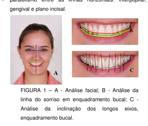 FIGURA 1 – A - Análise facial; B - Análise da linha do sorriso em enquadramento bucal; C  -Análise da inclinação dos longos eixos, enquadramento bucal.